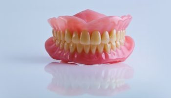 How Many Implants Do You Need for Upper Dentures?